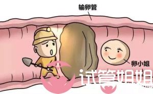 输卵管堵塞可以做试管婴儿吗？