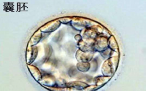 移植囊胚成功率是多少？囊胚移植后注意事项有哪些？