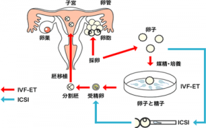 试管第二次移植费用是多少？要重新再做一次吗