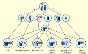 导致胚胎染色体异常的原因，胚胎染色体发生异常还能移植吗