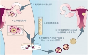 泰国试管的流程有哪些？泰国试管的流程需要几个步骤?