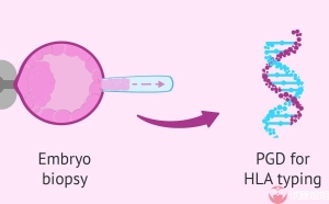 师生恋婚后在俄罗斯做三代试管选男孩成功案例分享！