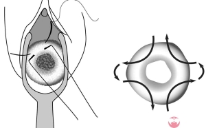 2024年佛山的私立机构做三代试管婴儿的水平如何？