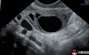 2024年在长沙当地的私立机构做三代试管婴儿的收费高吗？