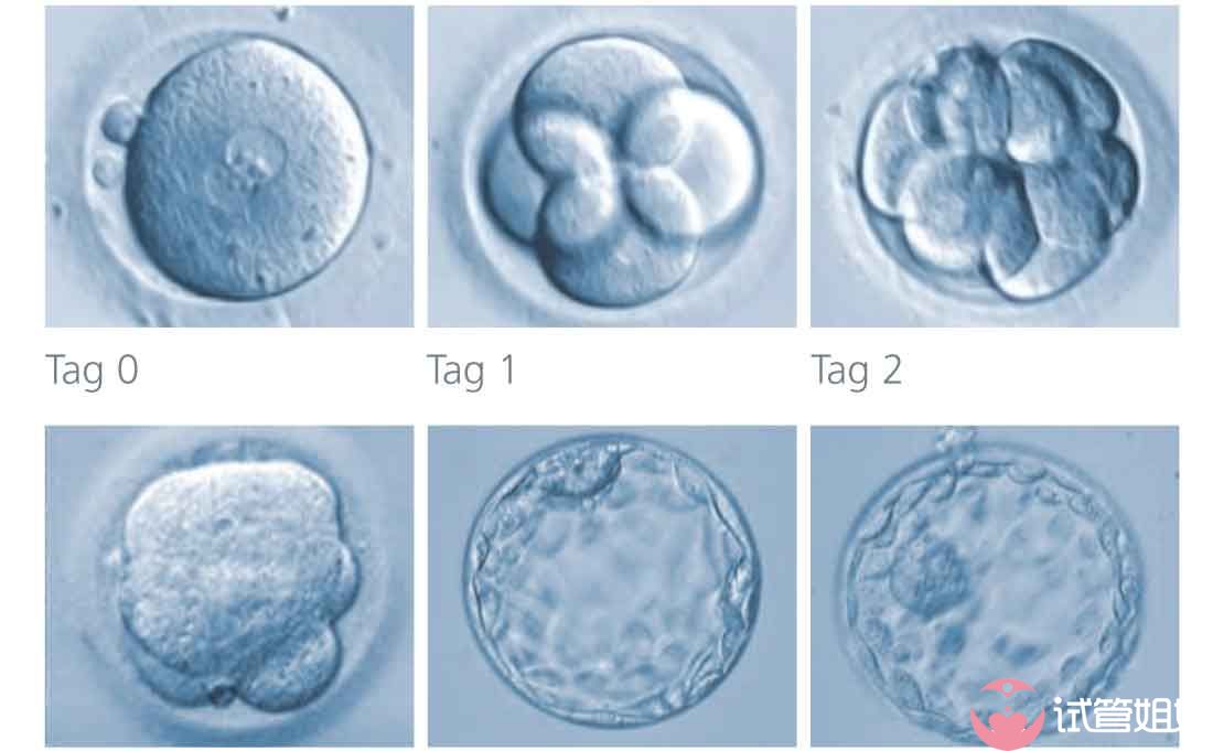 泰国试管婴儿是如何将囊胚移植的成功率做到最优的