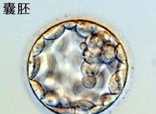 囊胚移植成功率