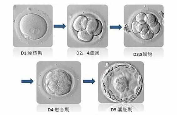 试管移植1个还是2个好