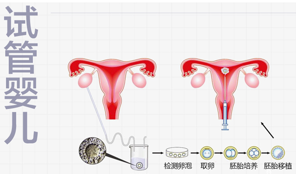 三代婴儿试管的费用要多少呢，试管的流程有哪些？