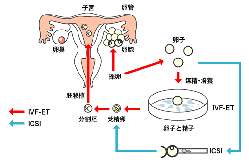 泰国第三代试管