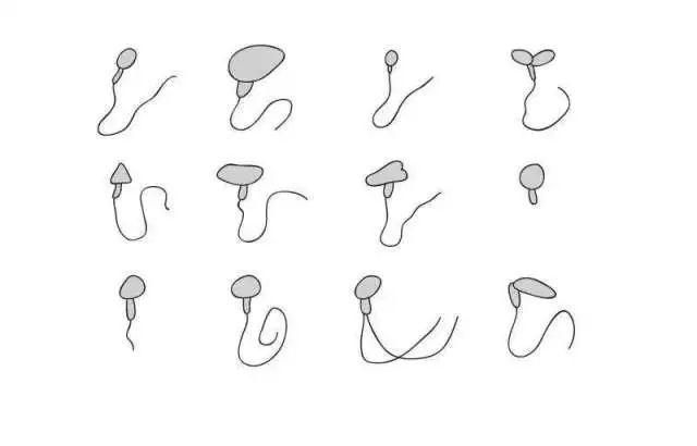 每个异常精子只有一种缺陷
