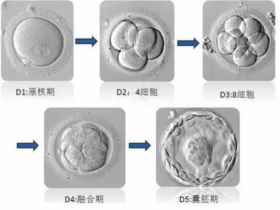 泰国试管婴儿