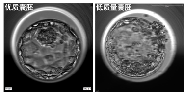 优质囊胚与低质量胚胎示例