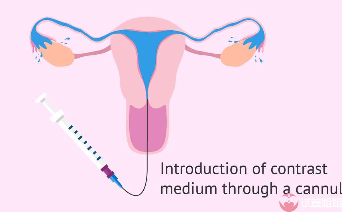 2023年单身女性在武汉做三代试管选男孩包成功可以吗